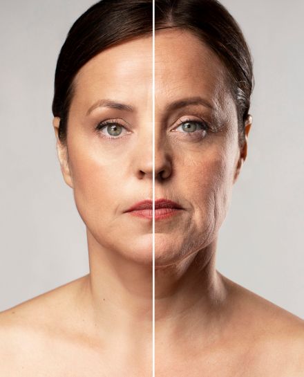 rejuvenecimientofacial