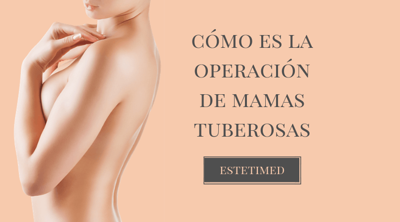 mamas-tuberosas