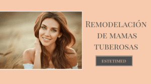 Todo lo que debes saber sobre la remodelacion de mamas tuberosas